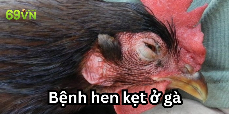 Nguyên nhân phổ biến khi mắc bệnh